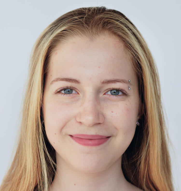 Illustrative portrait showing natural skin texture, not an analysis result